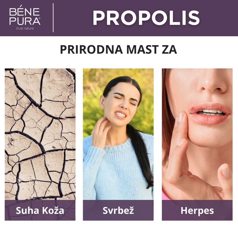 Mast za Svrbež s 30% Propolisom - 40ml