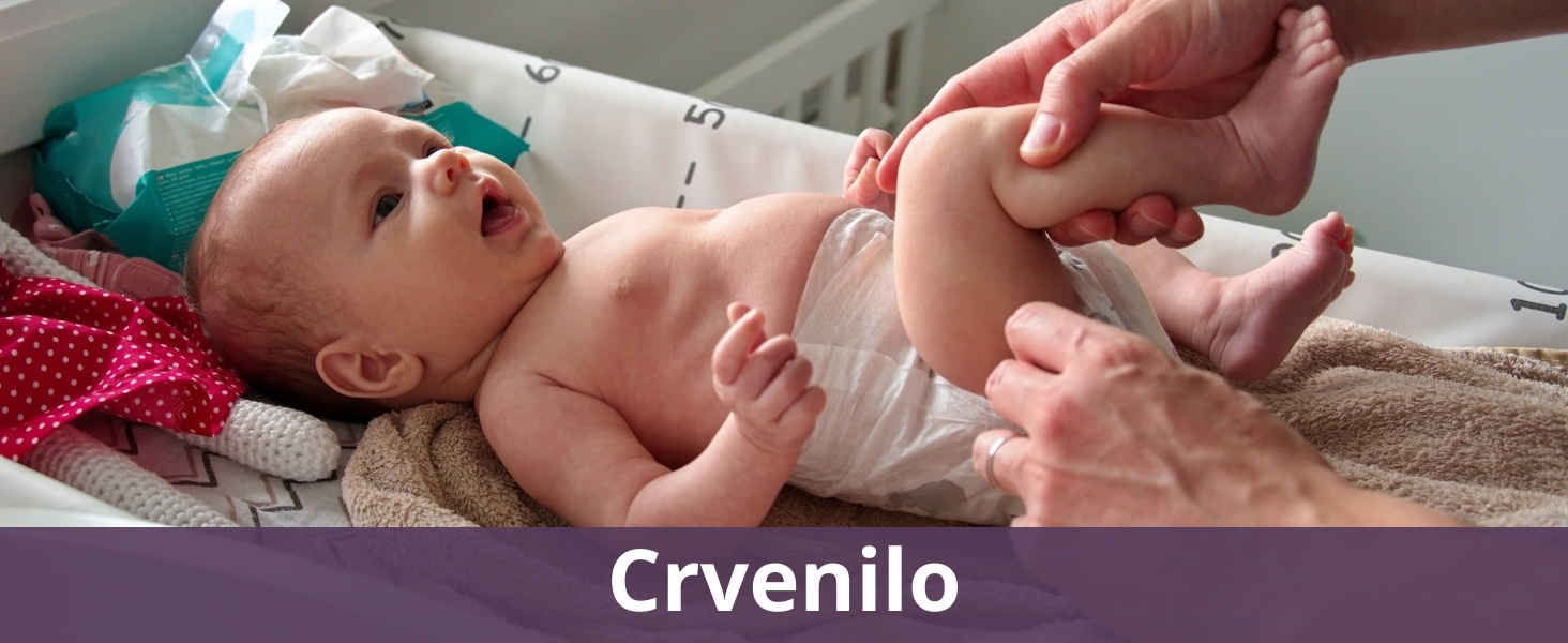 Crvenilo