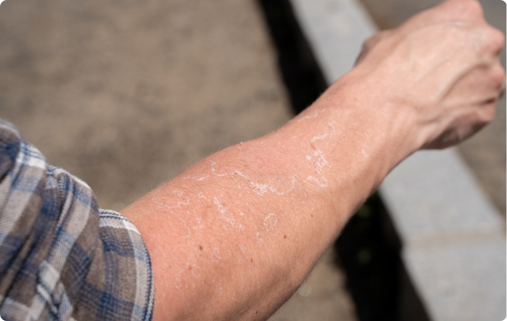 Kao ulje za iritiranu i suhu kožu