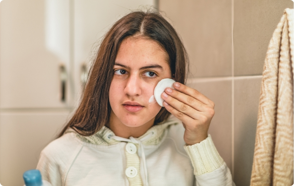 Kao tonik za masnu i problematičnu kožu