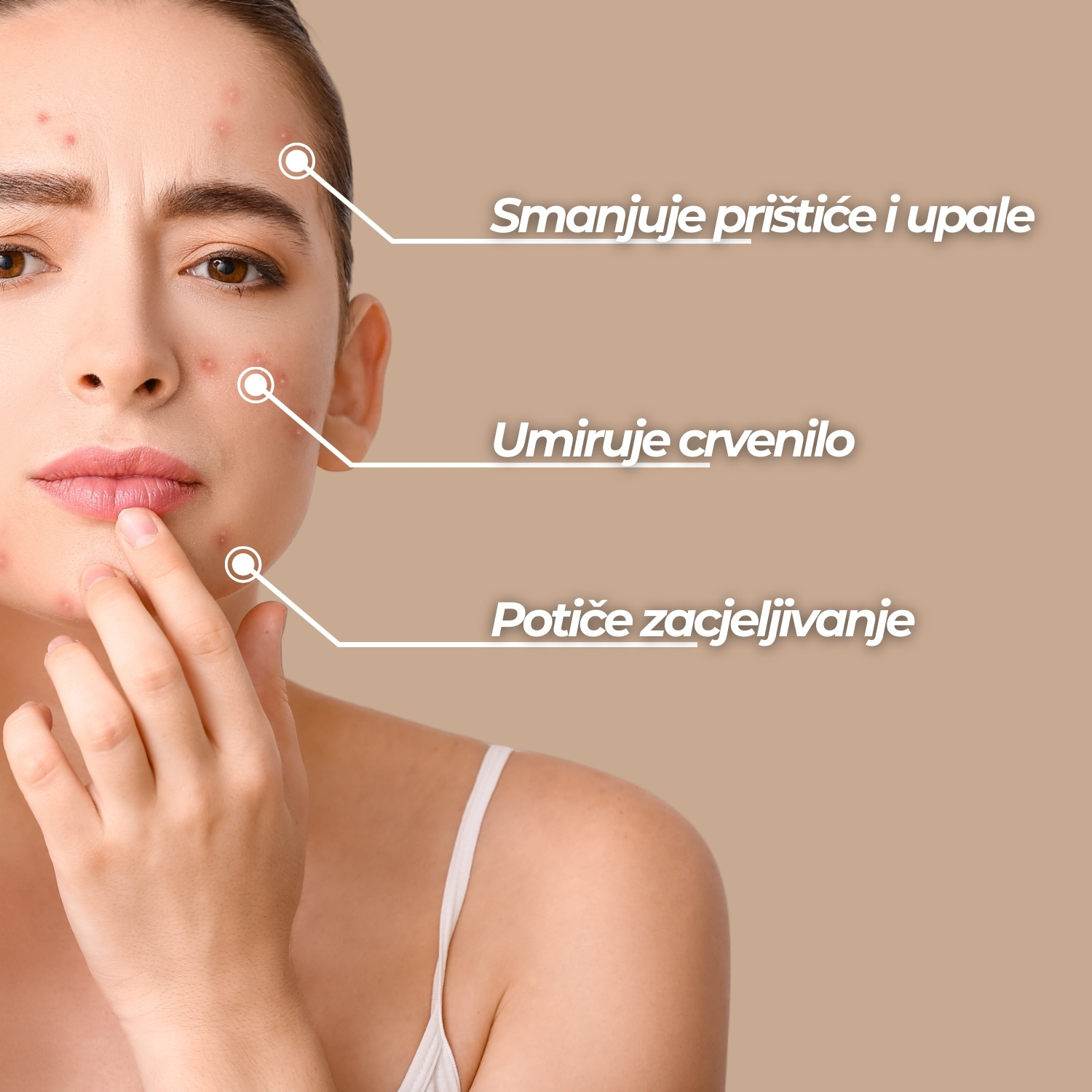 Set "Njega problematične kože"